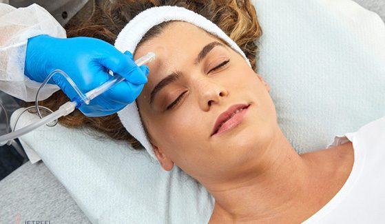 Oxygen Jet Peel – Mistä on kyse – kuva 8