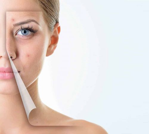 LED SPA happikapseli