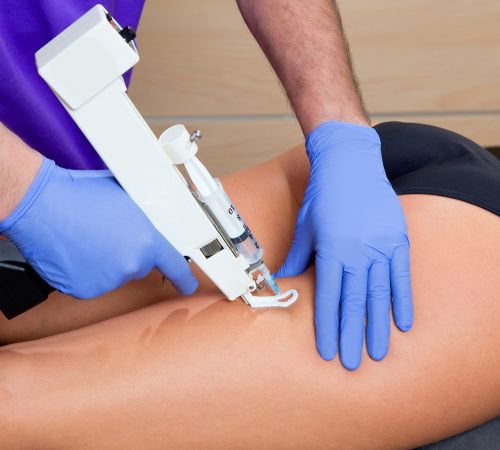Mesoterapia